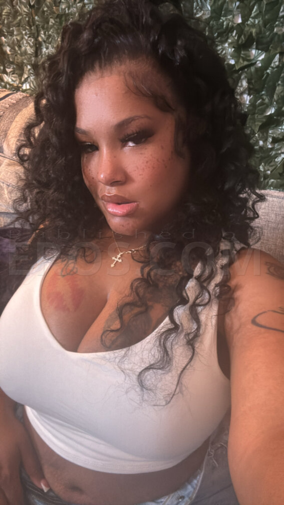 FRECKLE BABE