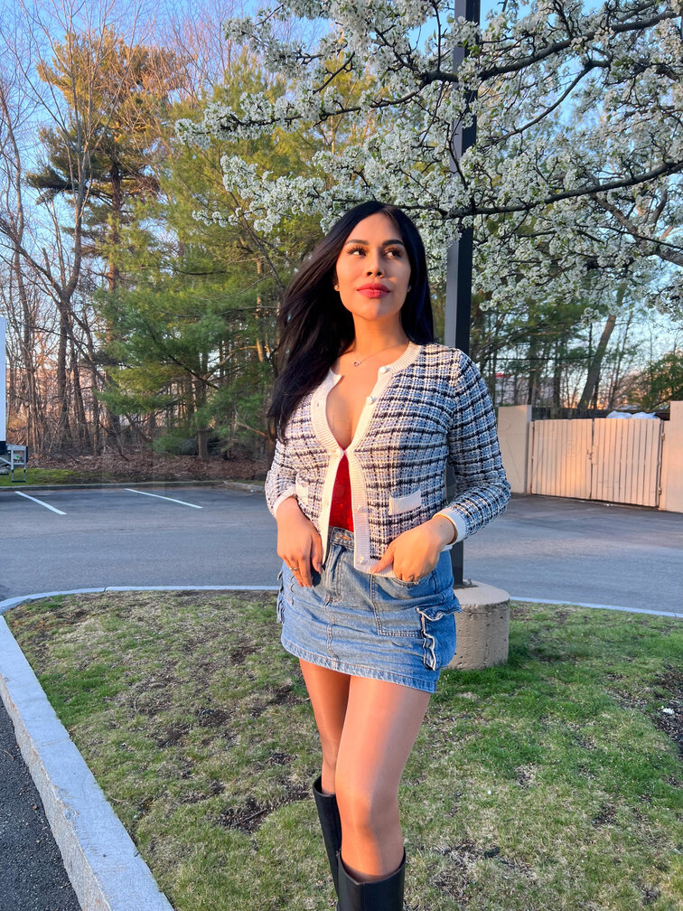BARBARA POST OP